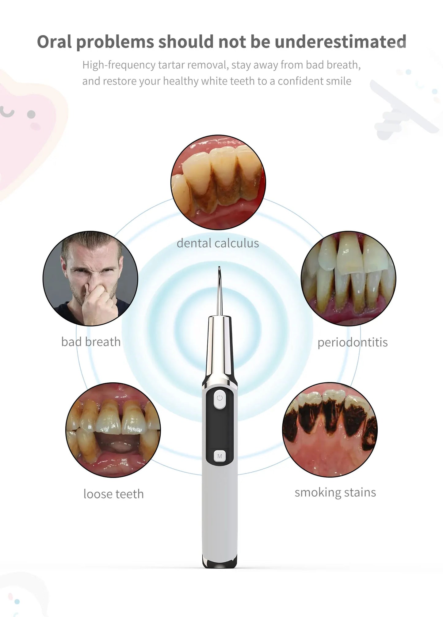 Xiaomi Ultrasonic Dental Scaler